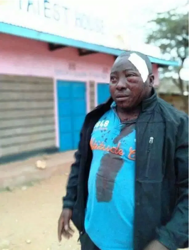 Pupils at Oldo in Isiolo brutally attack a teacher disfiguring his face(PHOTOs).