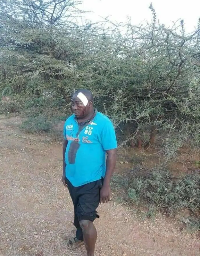 Pupils at Oldo in Isiolo brutally attack a teacher disfiguring his face(PHOTOs).