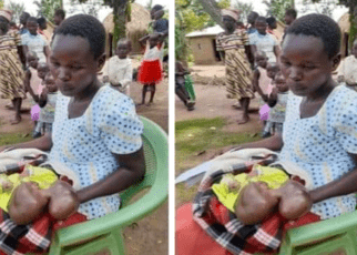 A 25 year girl from Omoloi town in Teso South sub-county is going through serious mental difficulty after her nine-month pregnancy which was expected to be a source of joy ended up being otherwise because of the infant's strange defects on the head.
