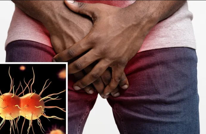 What You Should Know About The Super Gonorrhea That Has Stricken Nairobi