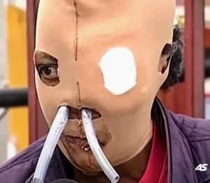 Cruel World: Disturbing Video Shows Black Woman Being Doused With Acid by Foreign Husband, Forced to Massage Him Despite Severe Injuries (VIDEO)