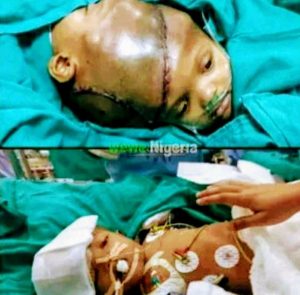 “Mummy, Are We Going to Die?” Two Conjoined Twins Ask Their Mother in Viral Video After Doctor’s Words About Failed Surgery (VIDEO)