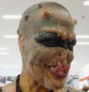 “He Can’t Eat or Drink”: Man Who Spent $45,676 on Cosmetic Surgery to Look Like Reptile Reportedly Regrets His Decision After Failed Surgery (VIDEO)