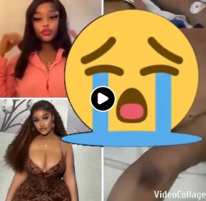 Heartbreaking Video Shows Woman Crying in Pain Moments After BBL Surgery Before Allegedly Passing Away (VIDEO)